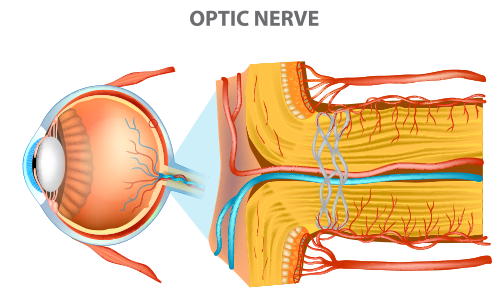 Optic Neuropathy Do You Know The Signs Atlanta Eye Care